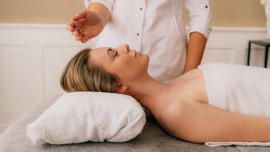 A person getting acupuncture needles in their forehead.